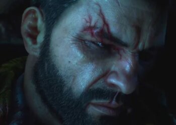 The Beast Treats Kyle Like the Ultimate Main Character